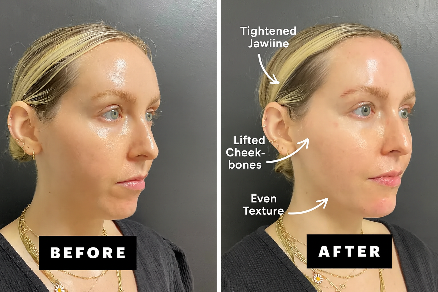 Snatch Band Face Shaper™